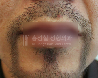 ゴーティー